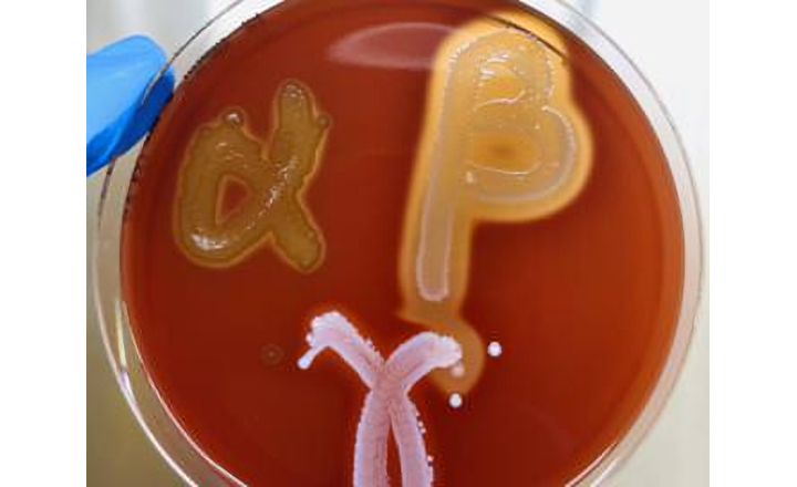 Clear Haeomolysis Results on Liofilchem Columbia Agar