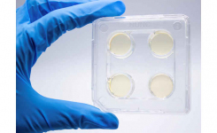 Suseptibility Testing Terbinafine and Itraconazole