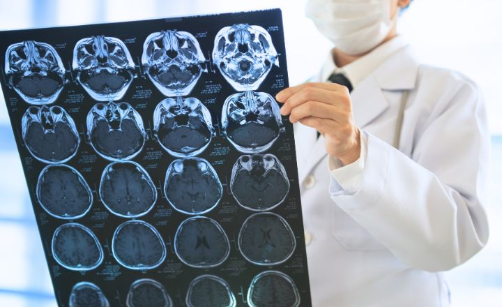 Surgeon reviews brain scans