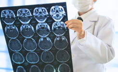 Surgeon reviews brain scans