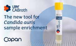 The New Tool for Candida Auris Sample Enrichment