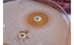 Antimicrobial Resistance Testing in CLSI M100