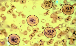 Cryptosporidium oocytes