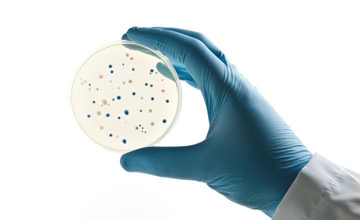 Improved recovery of ESBL-producing bacteria using chromogenic agar