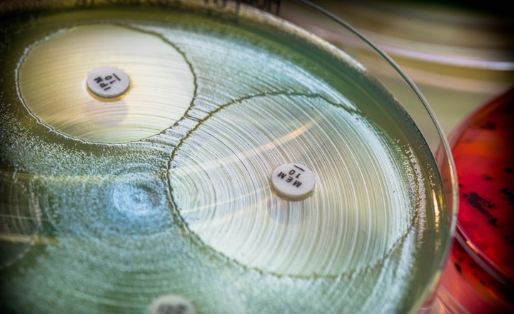 Fully automated AST testing for the clinical microbiology laboratory