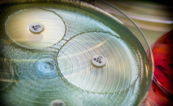 Fully automated AST testing for the clinical microbiology laboratory