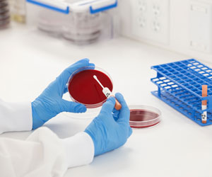 Microbiologics KWIK-STIK Reference Strains