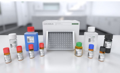 Measles Antibody Detection Assay Using DBS